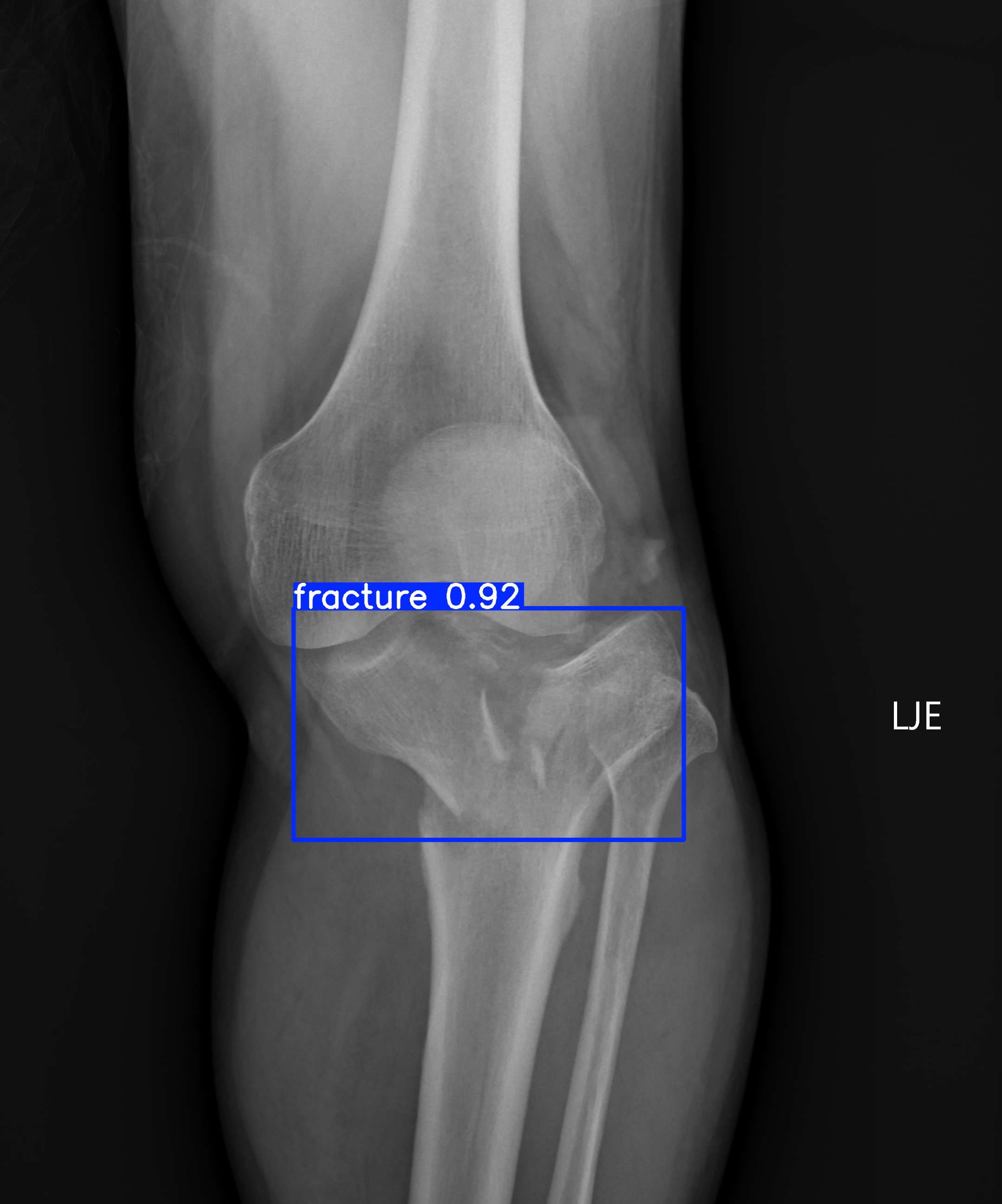 fracture_001563014F.jpg