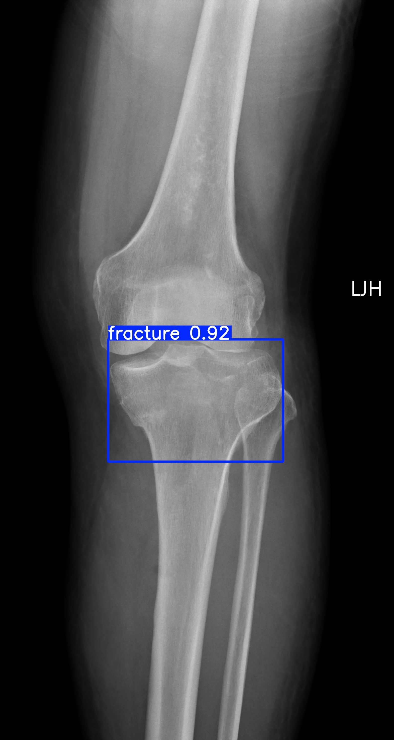 fracture_001818270C.jpg