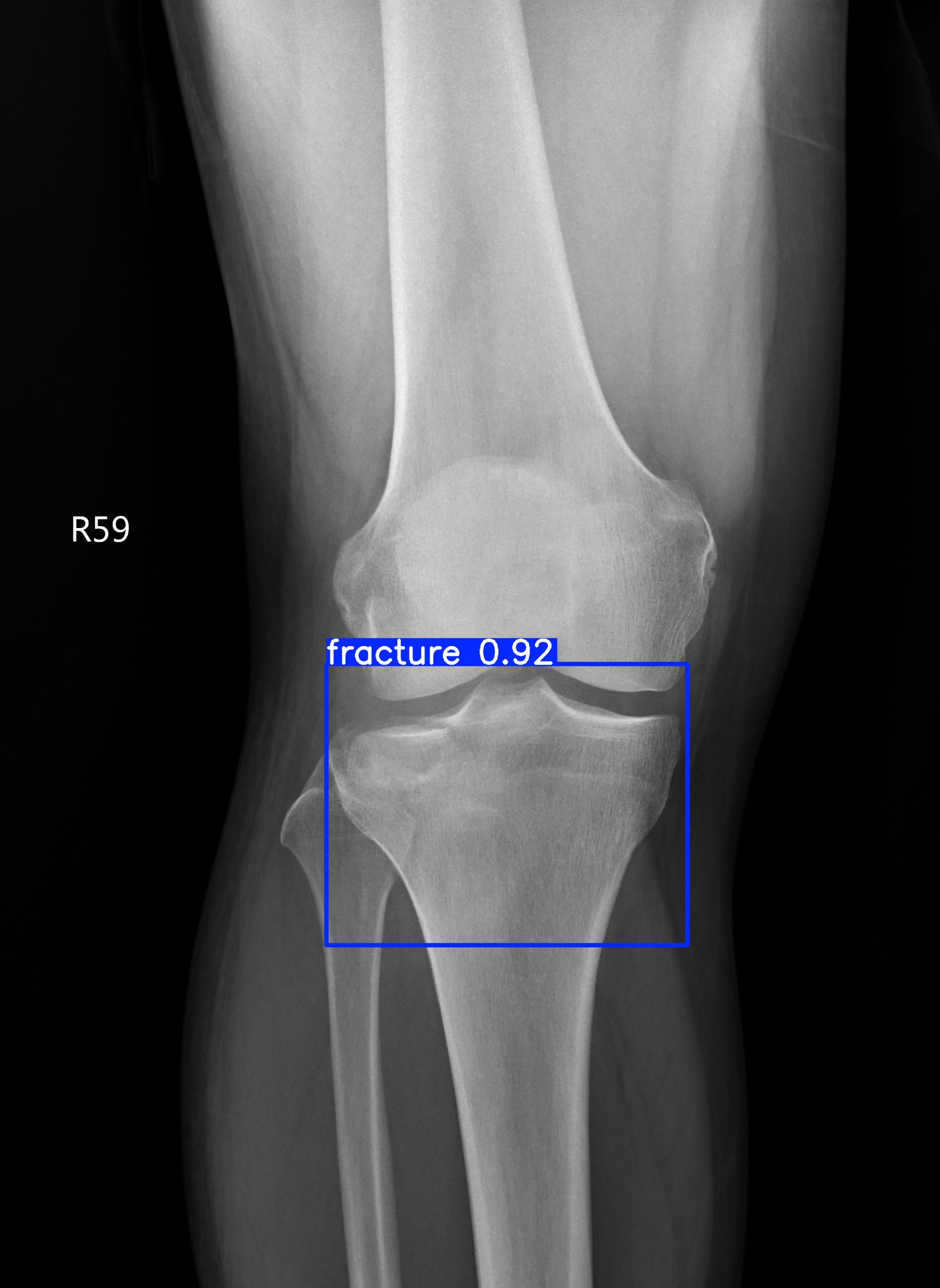 fracture_002539015C.jpg