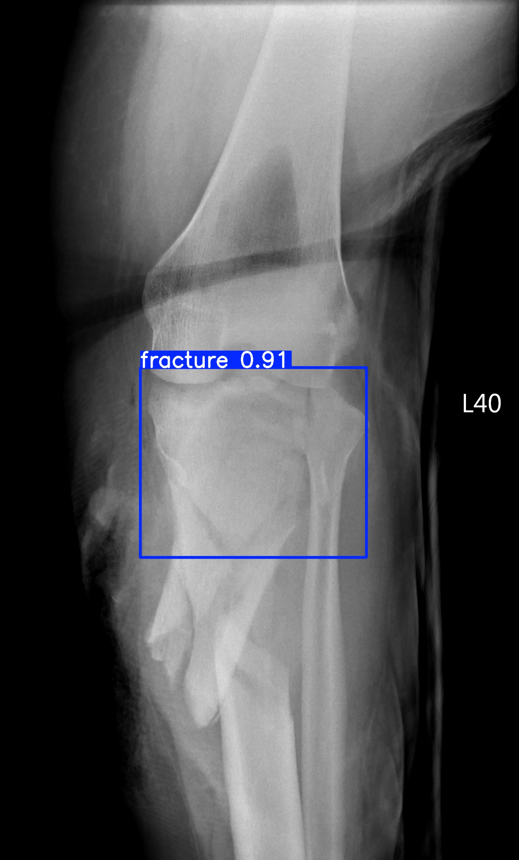fracture_002731999J.jpg