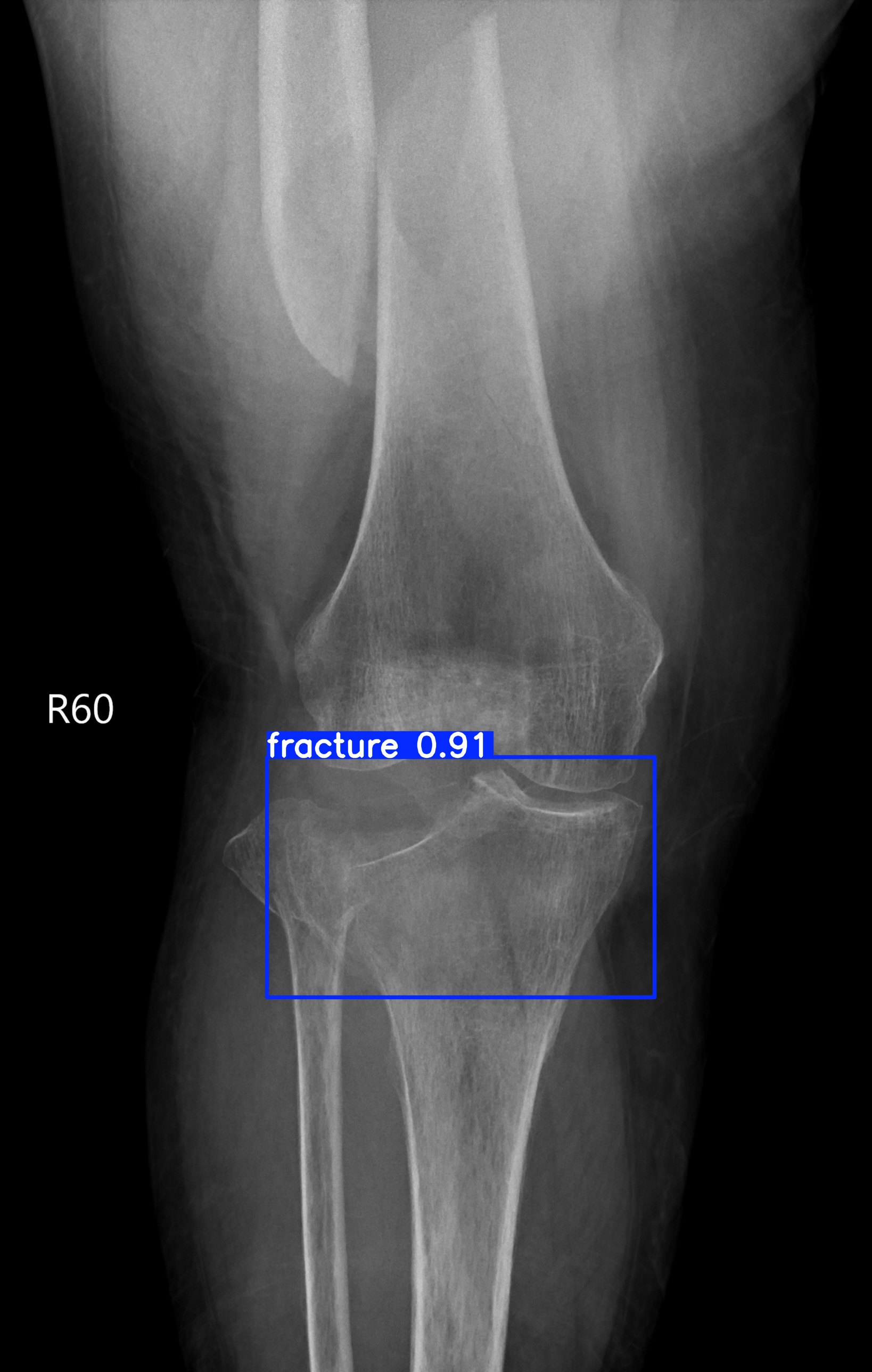 fracture_002751122E.jpg