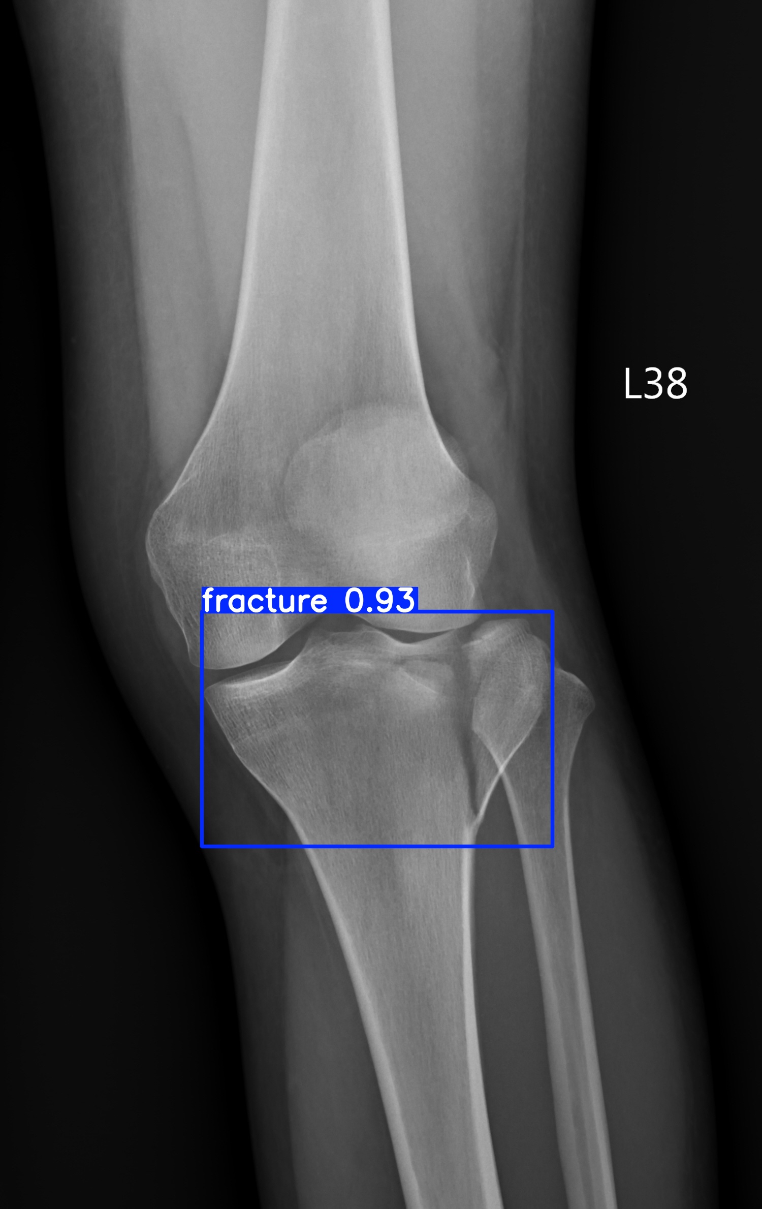 fracture_002751414D.jpg