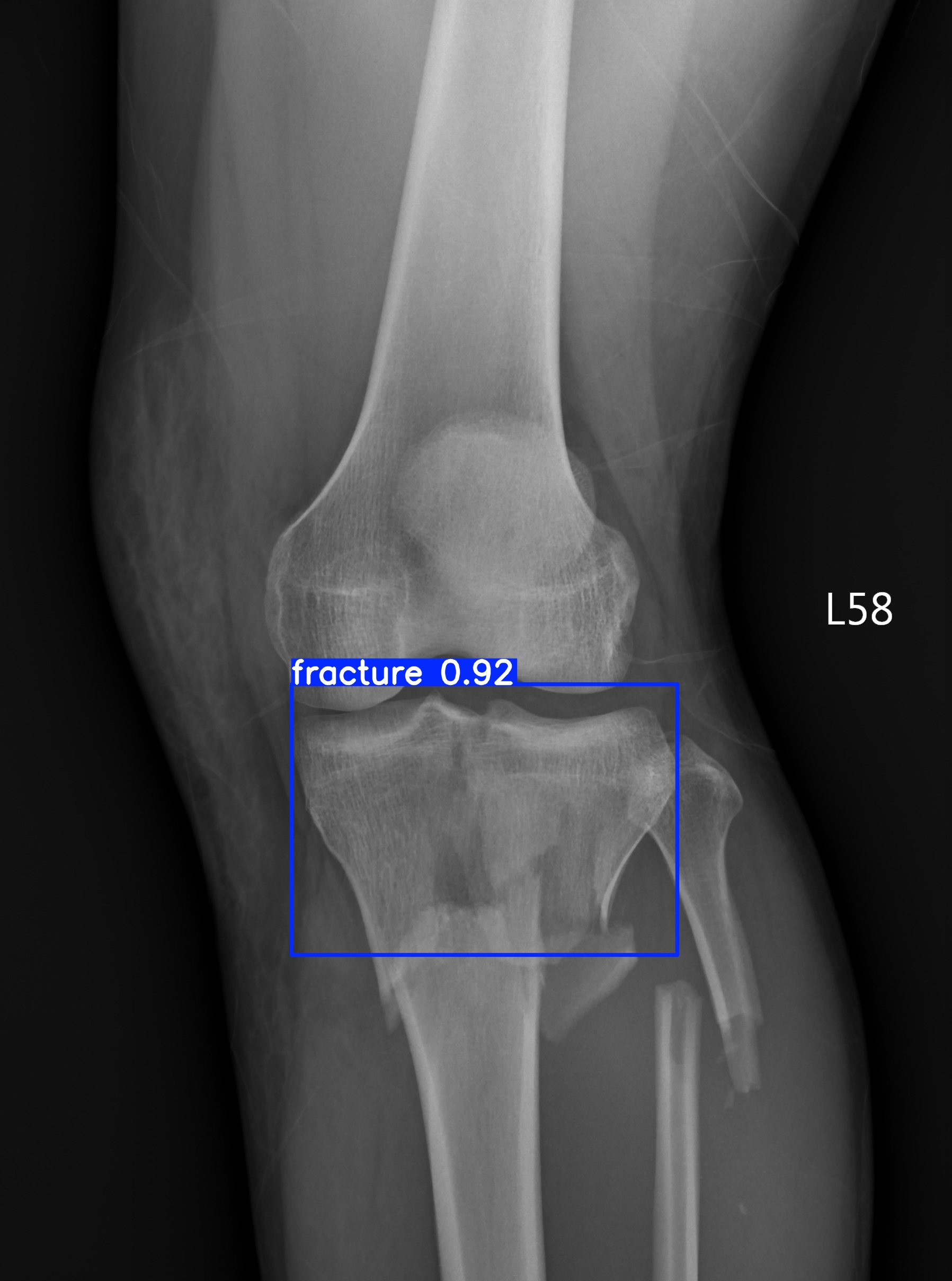 fracture_003232968D.jpg