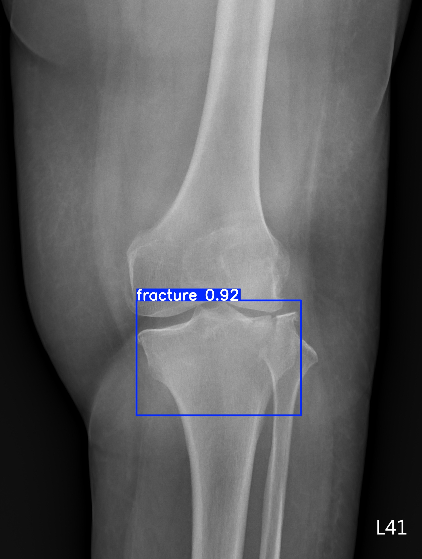 fracture_003249100C.jpg