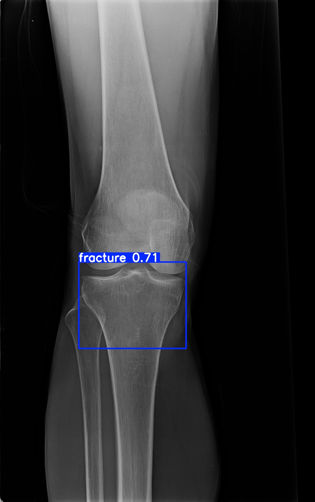 fracture_1 (10).jpg