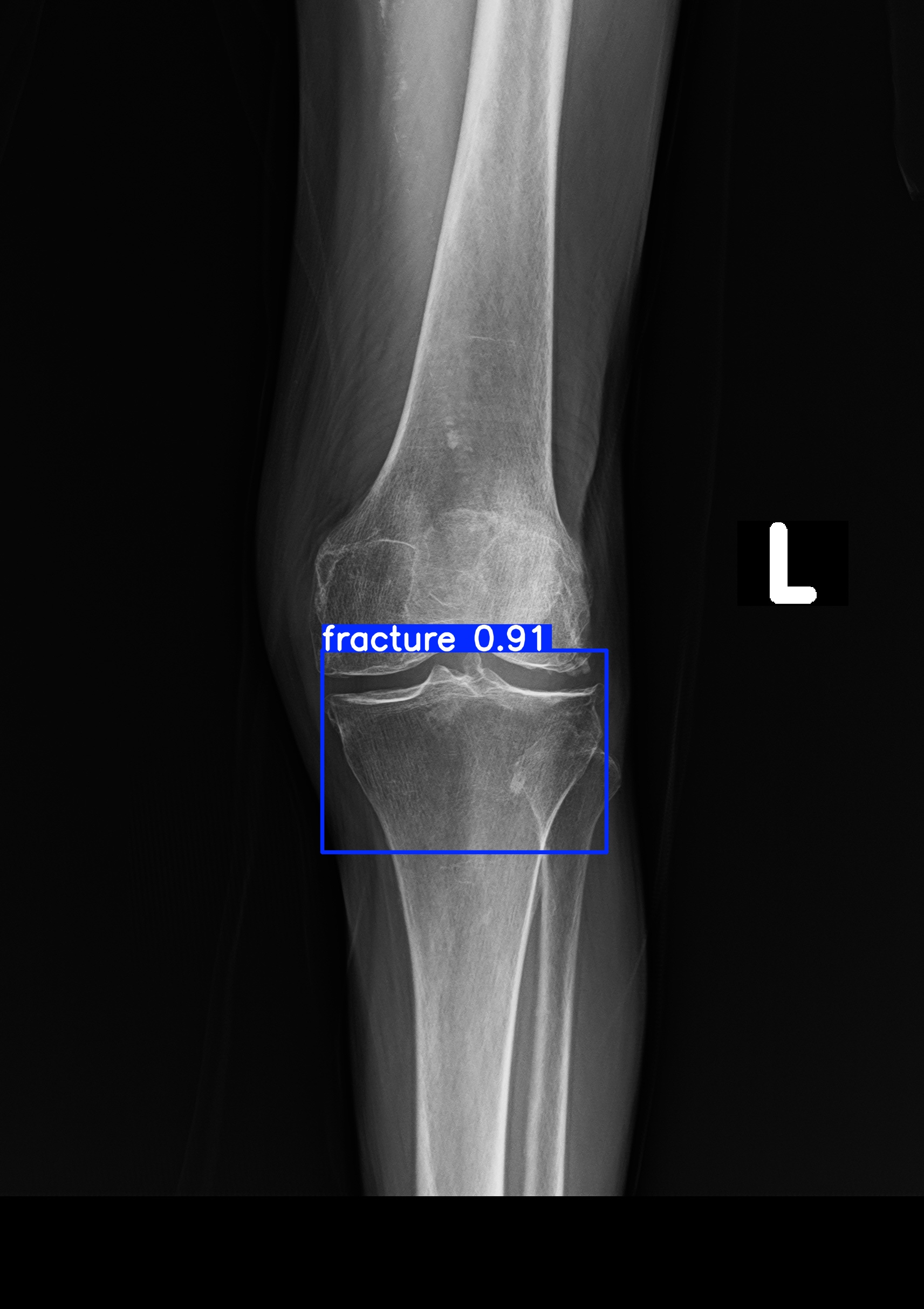 fracture_1 (16).jpg