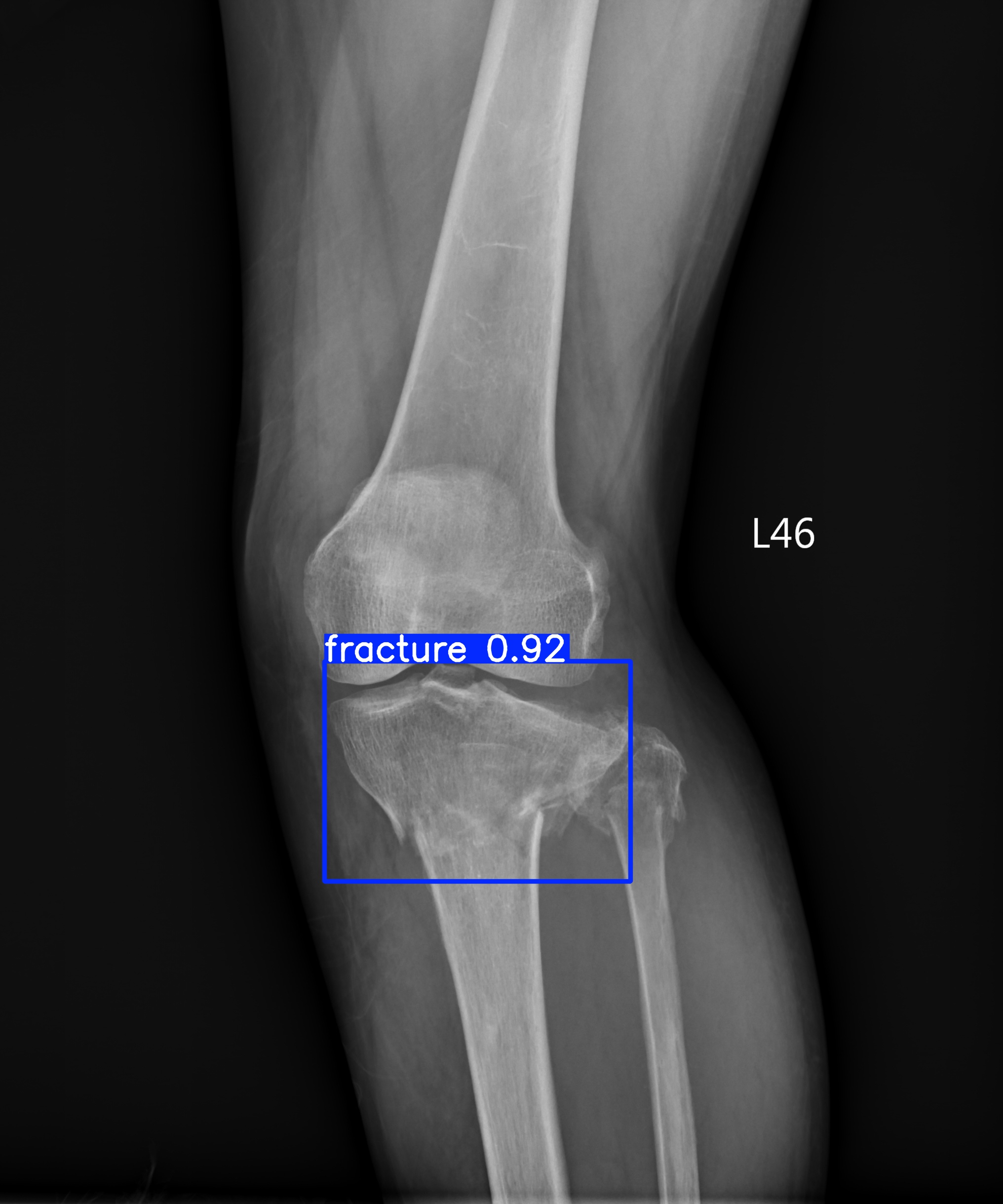 fracture_f_output.jpg