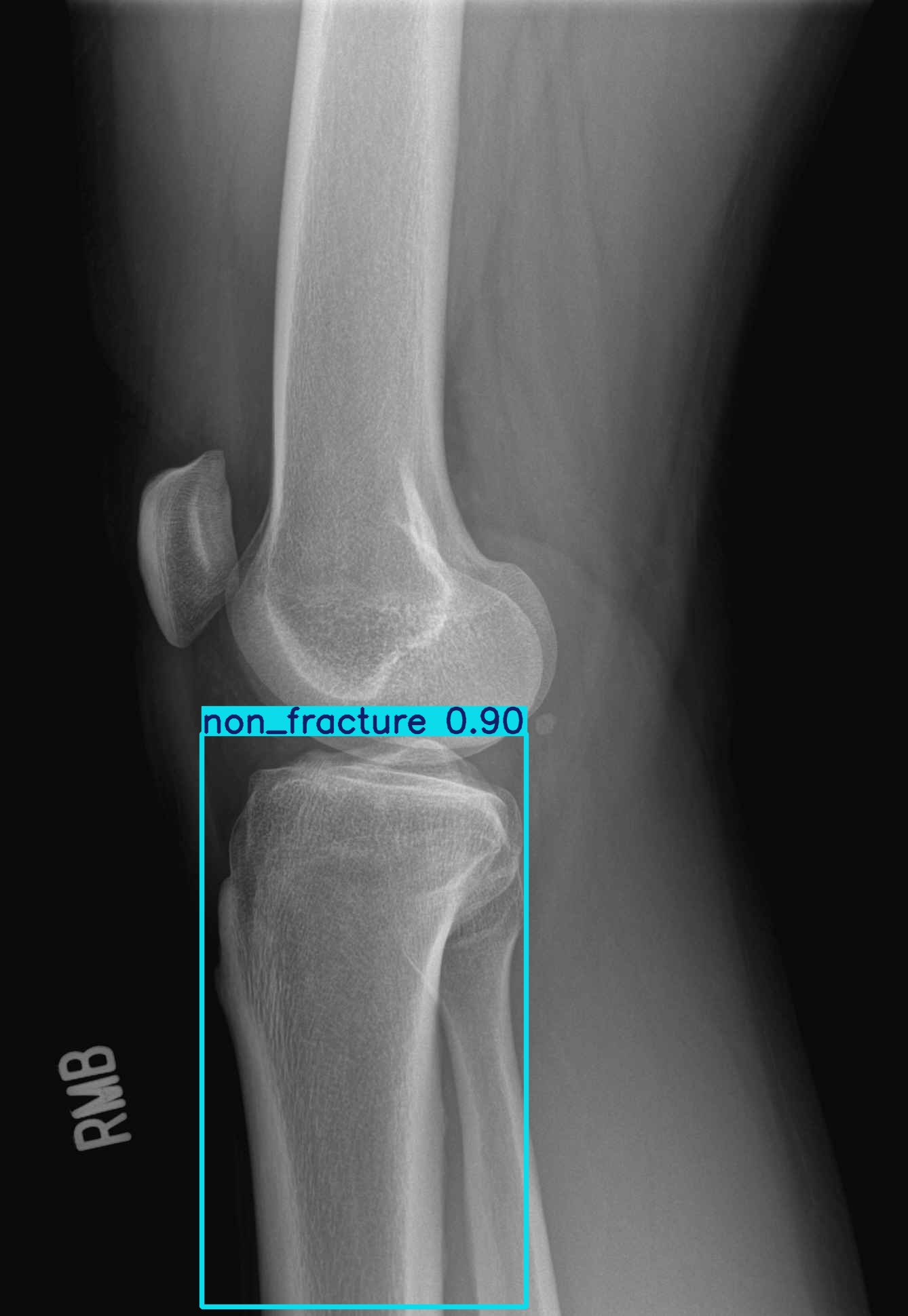 non_fracture_002680829H_12_1_1_2.jpg