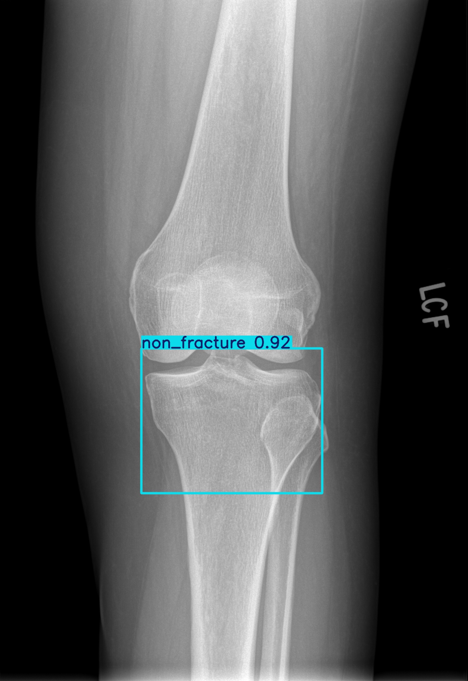 non_fracture_003024757F.jpg