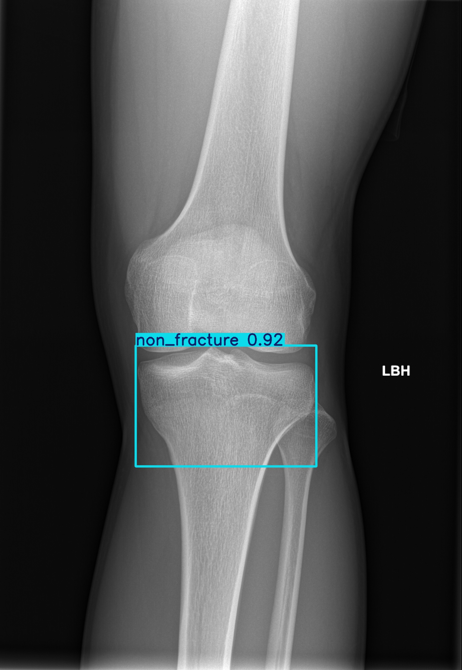 non_fracture_003027122I.jpg