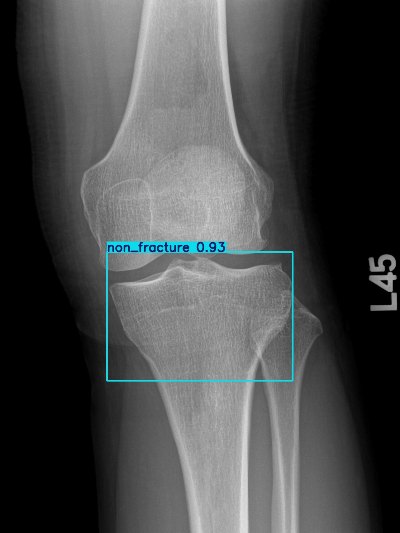 non_fracture_003053797E.jpg
