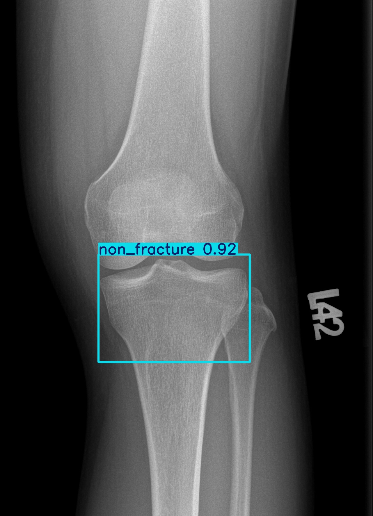 non_fracture_003061406D.jpg