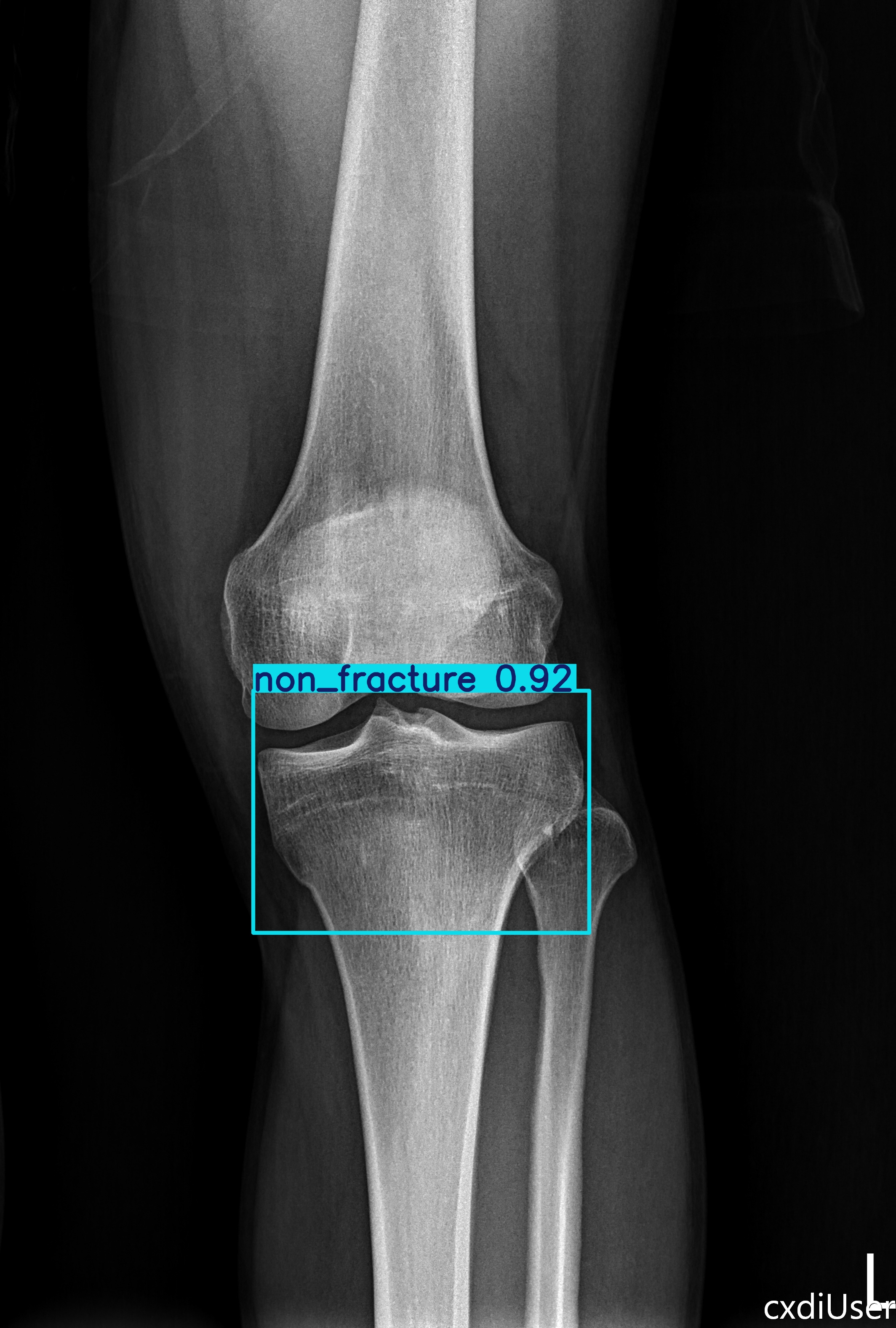 non_fracture_003077974J.jpg