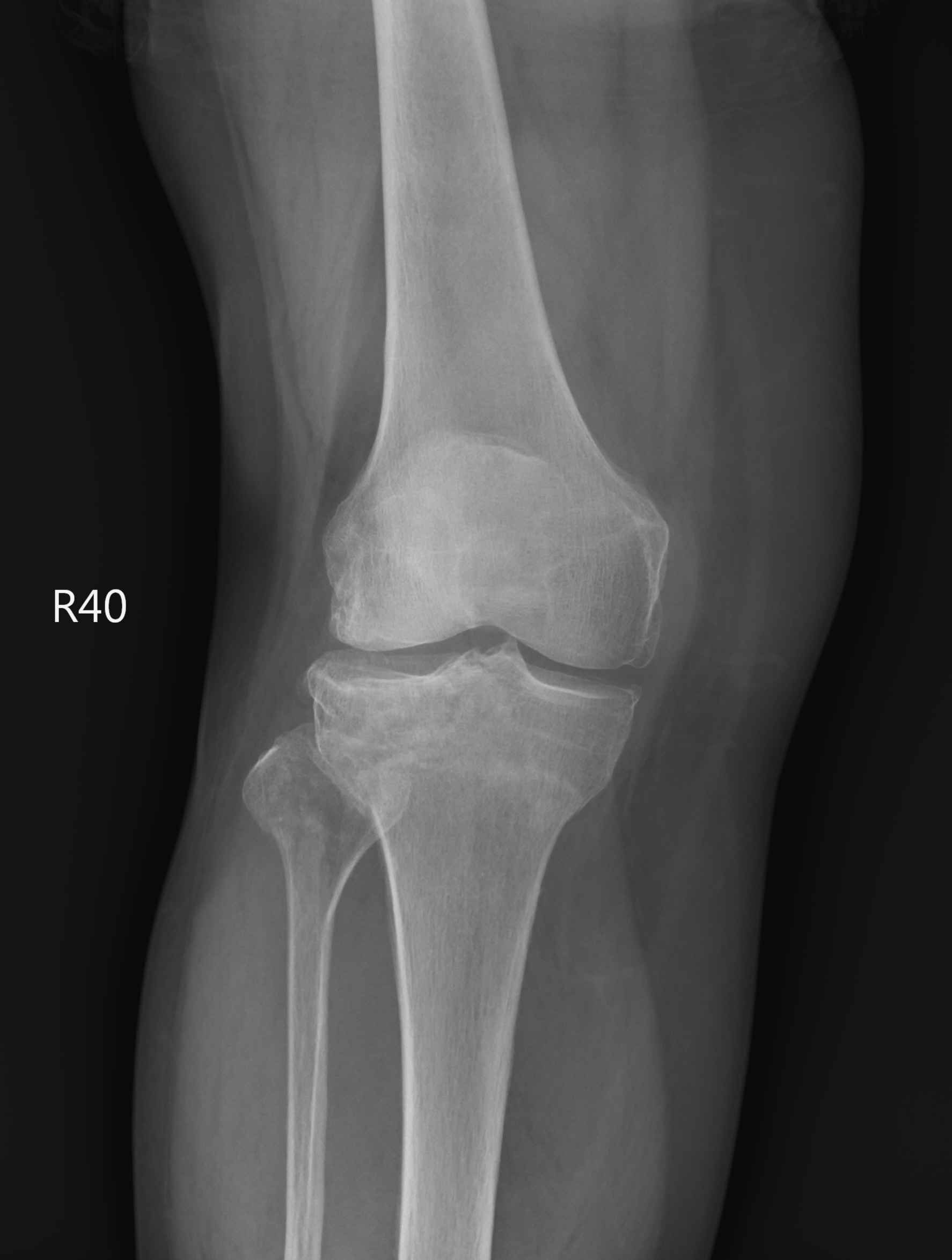 2. 001814547G_1_2_1_1.jpg