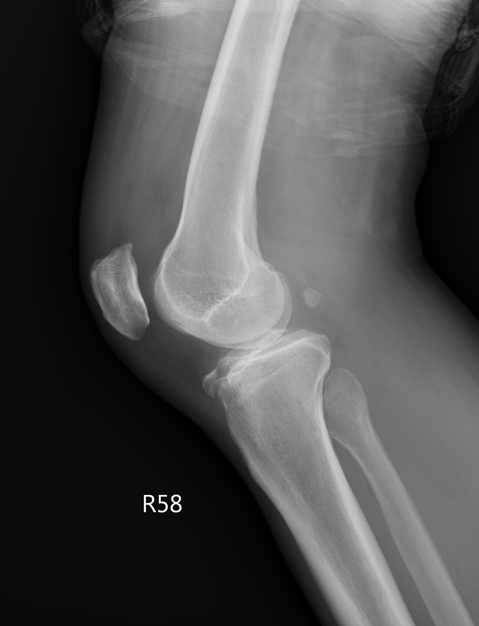 lateral_002764677B LAT.jpg