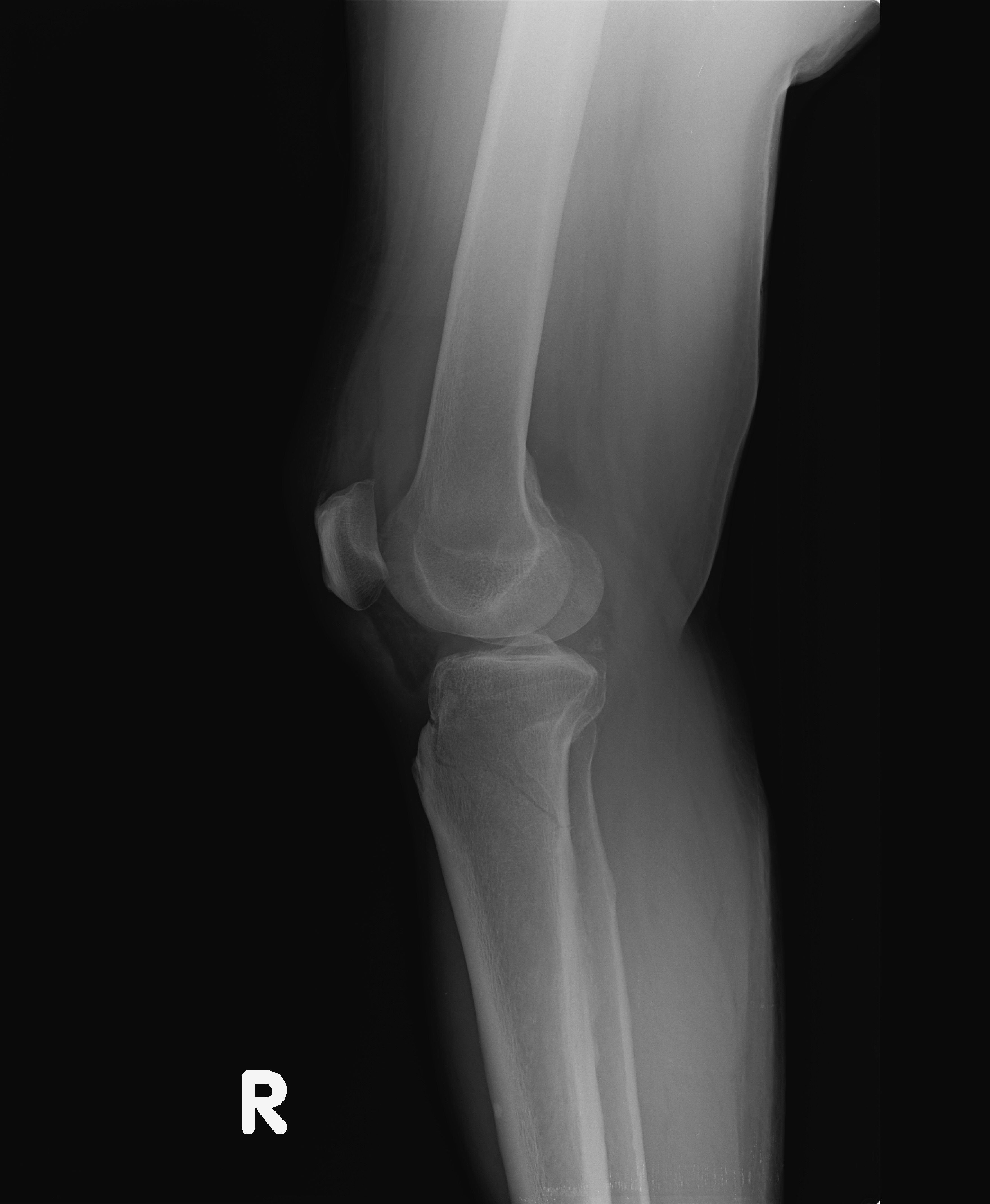 lateral_2-2.jpg