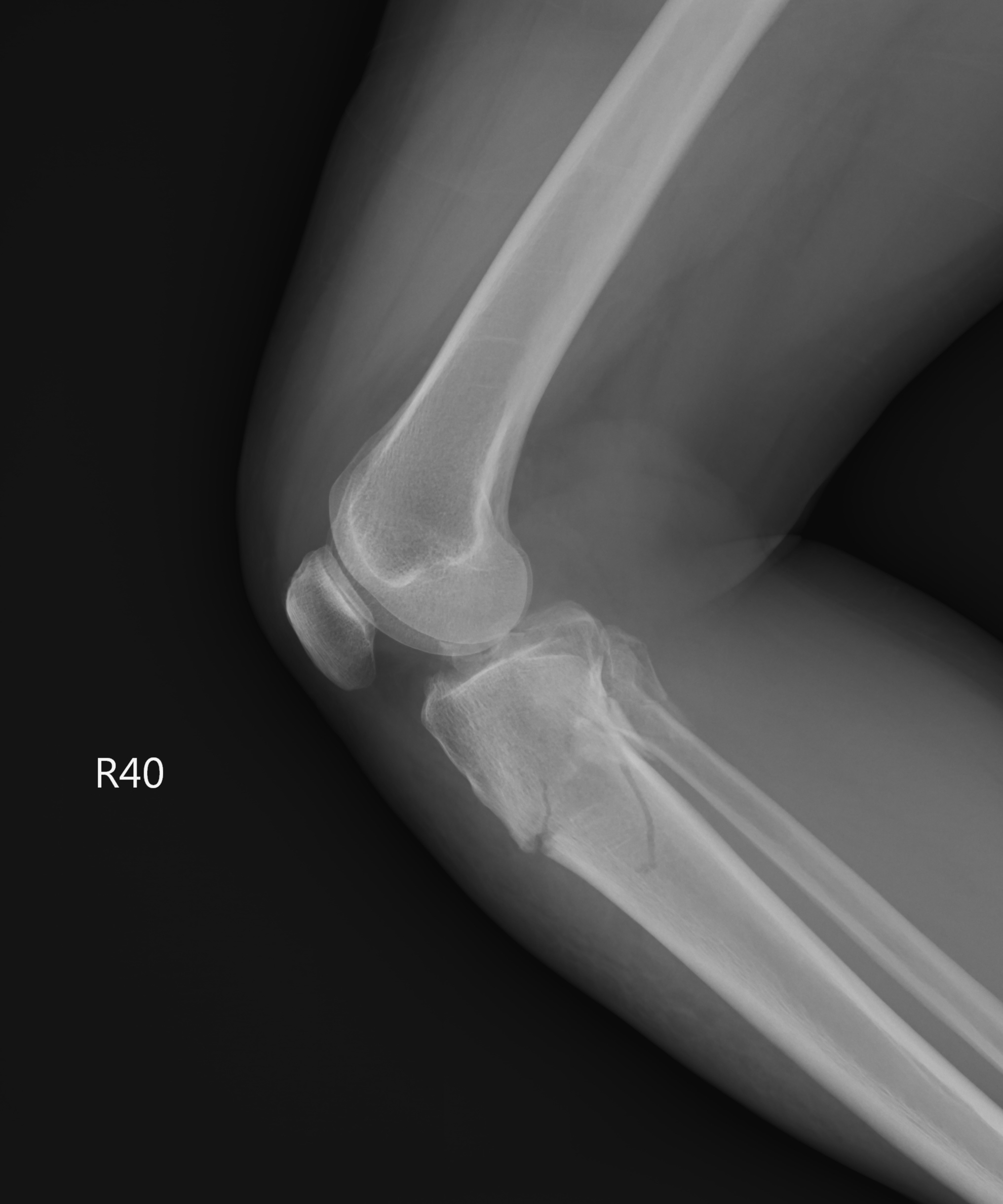 lateral_2.jpg