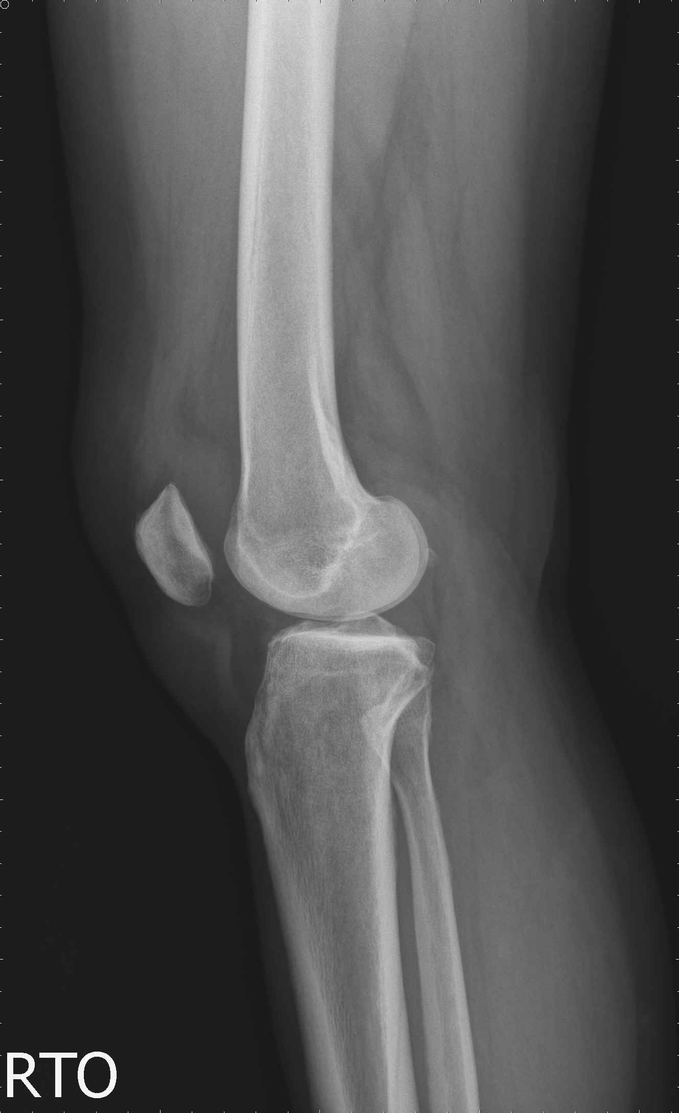 lateral_5_1_1_2.jpg